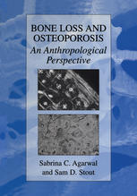 Bone Loss And Osteoporosis An Anthropological Perspective 1st Edition A Michael Parfitt Auth