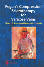 Fegans Compression Sclerotherapy For Varicose Veins 1st Edition S Sarin Auth