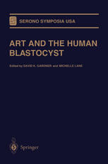 Art And The Human Blastocyst 1st Edition John A Schnorr Howard W Jones Jr Auth