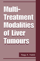 Multitreatment Modalities Of Liver Tumours 1st Edition Dominque Franco