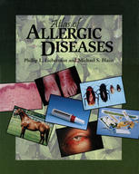 Atlas Of Allergic Diseases Fariba Behbod Gailen D Marshall Jr Auth