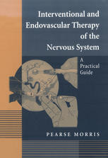 Interventional And Endovascular Therapy Of The Nervous System A Practical Guide 1st Edition Pearse Morris Md Auth