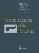 Transplantation Of The Pancreas 1st Edition Shalamar D Sibley
