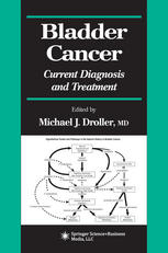 Bladder Cancer Current Diagnosis And Treatment 1st Edition Gunnar Steineck Md Auth