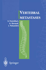 Vertebral Metastases 1st Edition Professor Vincent Pointillart