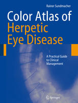 Color Atlas Of Herpetic Eye Diseases A Practical Guide To Clinical Management 1st Edition Hartmut Hengel Auth