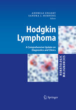 Hodgkin Lymphoma A Comprehensive Update On Diagnostics And Clinics Sally L Glaser