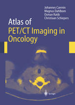 Atlas Of Petct Imaging In Oncology 1st Edition J Czernin Md