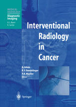 Interventional Radiology In Cancer 1st Edition D Sahani B Bounds