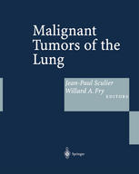 Malignant Tumors Of The Lung Evidencebased Management 1st Edition W A Franklin