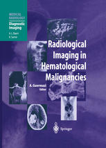 Radiological Imaging In Hematological Malignancies 1st Edition Bachir Taouli Md