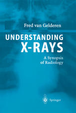 Understanding Xrays A Synopsis Of Radiology 1st Edition Dr Fred Van Gelderen Auth