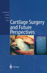 Cartilage Surgery And Future Perspectives 1st Edition Thomas Aigner