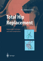 Total Hip Replacement Implantation Technique And Local Complications 1st Edition Susanna Häfliger