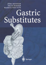 Gastric Substitutes 1st Edition Dr Med J Metzger Prof Dr Med F Harder