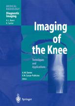 Imaging Of The Knee Techniques And Applications Kjell Jonsson Md