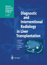 Diagnostic And Interventional Radiology In Liver Transplantation 1st Edition G Kazemier Md