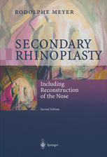 Secondary Rhinoplasty Including Reconstruction Of The Nose 2nd Edition Dr Rodolphe Meyer