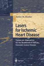 Lasers For Ischemic Heart Disease Update On Alternatives For The Treatment Of Diffuse Coronary Artery Disease 1st Edition Xavier M Mueller Auth