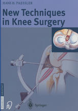 New Techniques In Knee Surgery 1st Edition Prof Hans H Paessler Md Auth