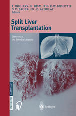 Split Liver Transplantation Theoretical And Practical Aspects 1st Edition Jb Otte Auth