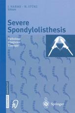 Severe Spondylolisthesis Pathology Diagnosis Therapy 1st Edition R L Dewald Auth