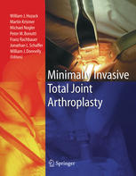 Minimally Invasive Total Joint Arthroplasty L Baergavarela