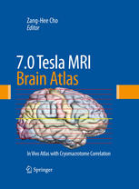 70 Tesla Mri Brain Atlas In Vivo Atlas With Cryomacrotome Correlation Zanghee Cho Phd Auth