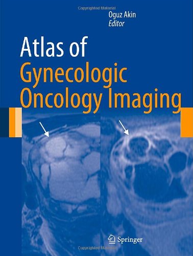 Atlas Of Gynecologic Oncology Imaging 2014th Edition Oguz Akin