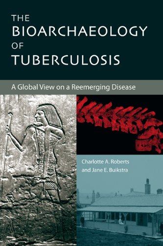 The Bioarchaeology Of Tuberculosis A Global View On A Reemerging Disease 1st Charlotte Roberts
