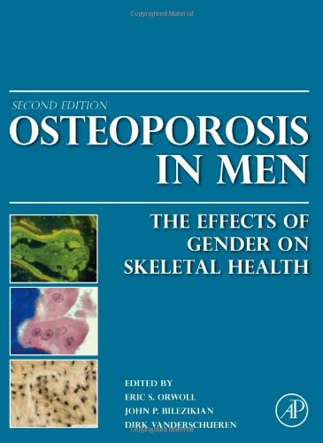 Osteoporosis In Men Second Edition The Effects Of Gender On Skeletal Health 2nd Edition Eric S Orwoll