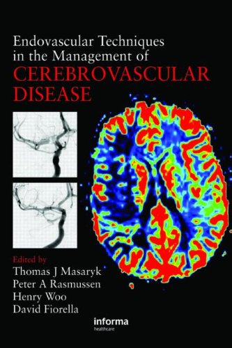 Endovascular Techniques In The Management Of Cerebrovascular Disease 1st Edition Thomas J Masaryk