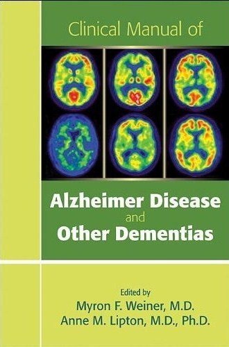 Clinical Manual Of Alzheimer Disease And Other Dementias 1st Edition Myron F
