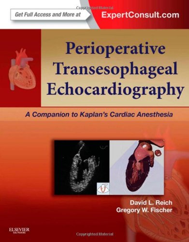 Perioperative Transesophageal Echocardiography 1 Harpsc David L Reich Auth