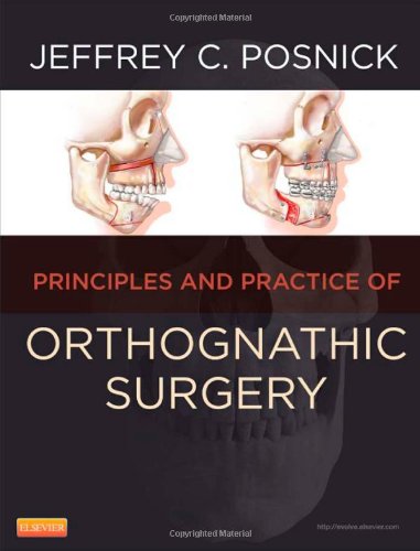 Orthognathic Surgery Principles And Practice 1 Harpsc Jeffrey C Posnick