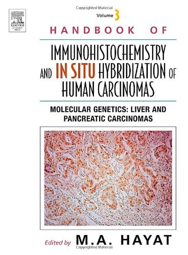 Molecular Genetics Liver Carcinoma And Pancreatic Carcinoma 1st Edition Ma Hayat Eds