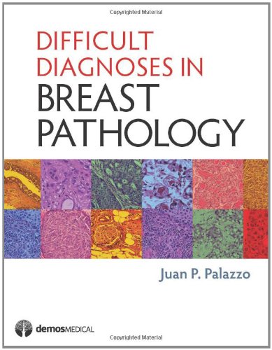 Difficult Diagnoses In Breast Pathology 1st Edition Juan P Palazzo Md