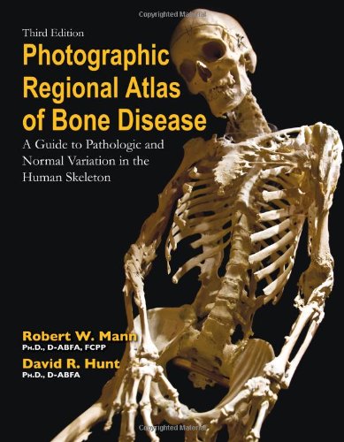 Photographic Regional Atlas Of Bone Disease A Guide To Pathologic And Normal Variations In The Human Skeleton 3rd Edition Robert W Mann