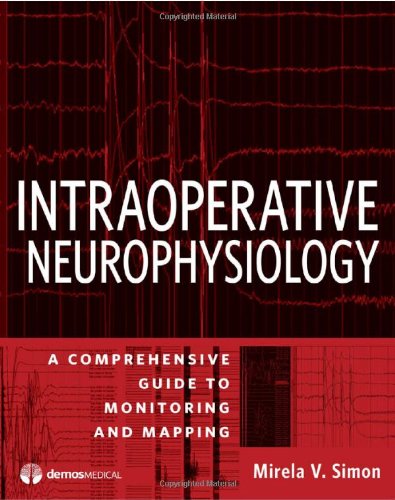 Intraoperative Neurophysiology A Comprehensive Guide To Monitoring And Mapping First Mirela V Simon Md