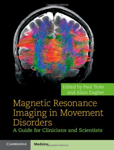 Magnetic Resonance Imaging In Movement Disorders A Guide For Clinicians And Scientists 1st Edition Tuite P