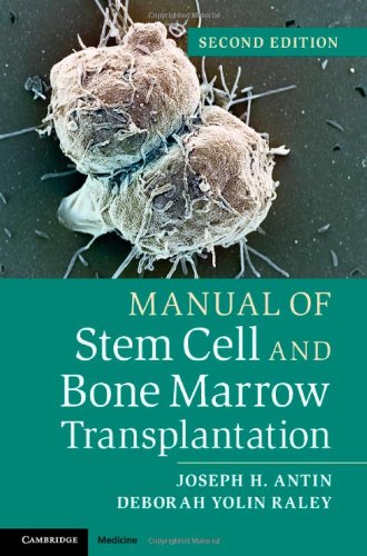 Manual Of Stem Cell And Bone Marrow Transplantation 2ed Antin Jh