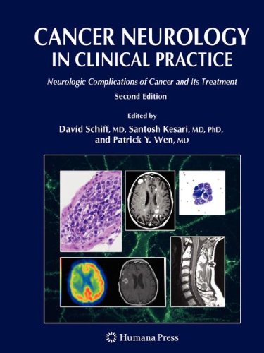 Cancer Neurology In Clinical Practice Neurologic Complications Of Cancer And Its Treatment 2nd David Schiff