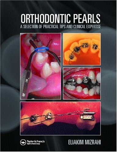Orthodontic Pearls A Selection Of Practical Tips And Clinical Expertise 1st Edition Eliakim Mizrahi