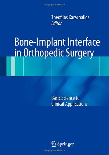 Boneimplant Interface In Orthopedic Surgery Basic Science To Clinical Applications 2014th Edition Theofilos Karachalios