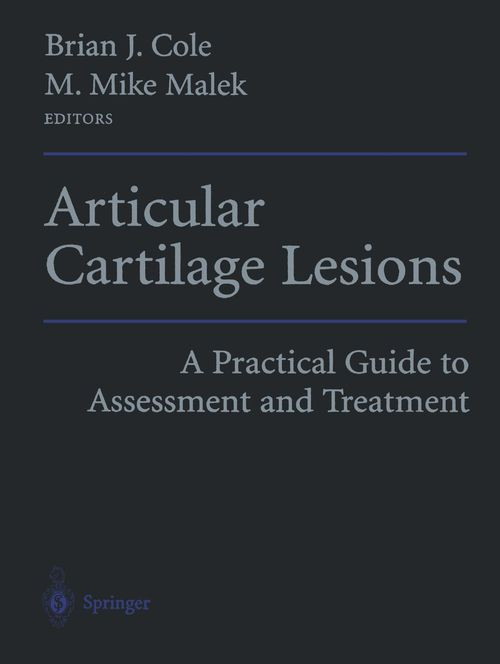 Articular Cartilage Lesions A Practical Guide To Assessment And Treatment 1st Edition Brian J Cole