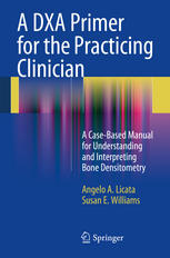 A Dxa Primer For The Practicing Clinician A Casebased Manual For Understanding And Interpreting Bone Densitometry 1st Edition Angelo A Licata