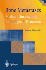 Bone Metastases Medical Surgical And Radiological Treatment 1st Edition L Garbegalanti Auth