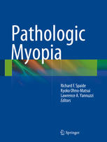 Pathologic Myopia 1st Edition Vinnie P Shah Md Nankai Wang Md