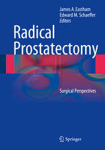 Radical Prostatectomy Surgical Perspectives 1st Edition Lincoln Tan Mbbs