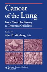 Cancer Of The Lung From Molecular Biology To Treatment Guidelines 1st Edition Kim Josen Md